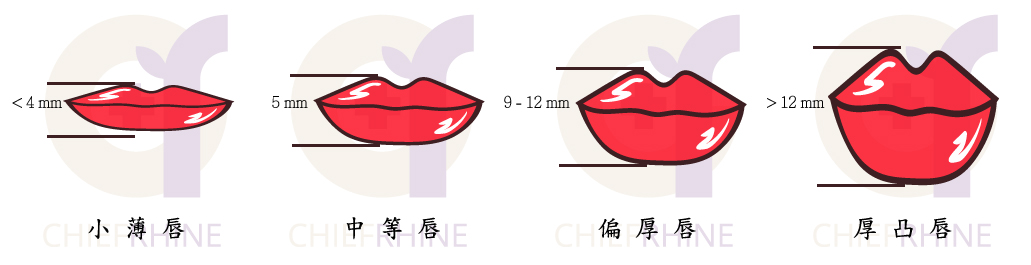 嘴唇類型示意圖