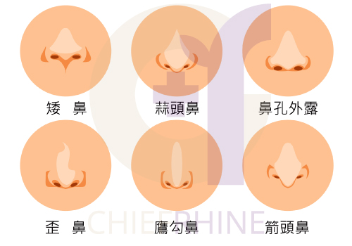 常見的6大鼻形示意圖