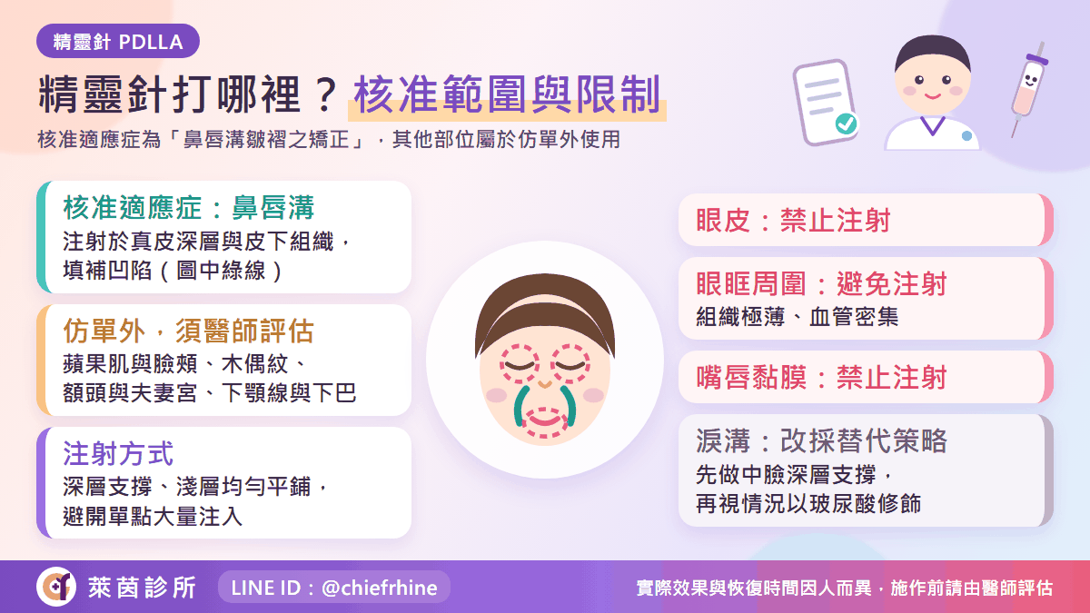 精靈針施打部位示意圖:核准適應症範圍與使用限制