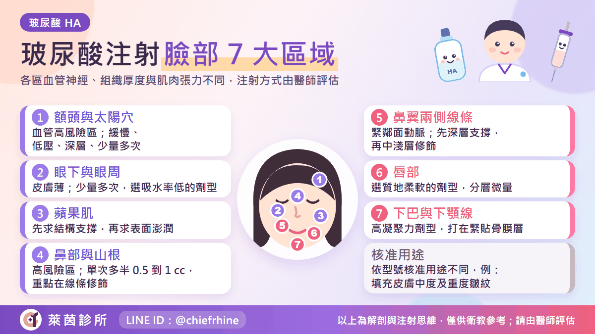 玻尿酸注射臉部 7 大部位示意圖