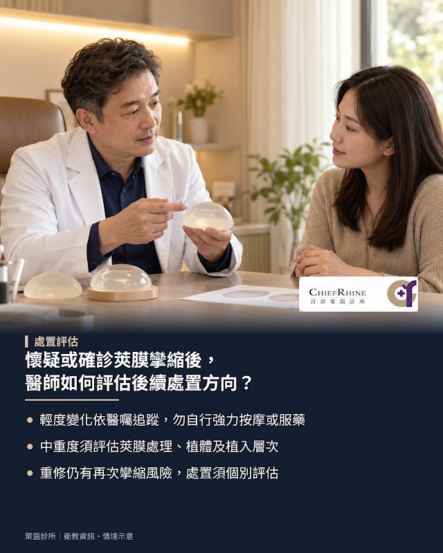 懷疑或確診莢膜攣縮後,醫師如何評估後續處置方向?