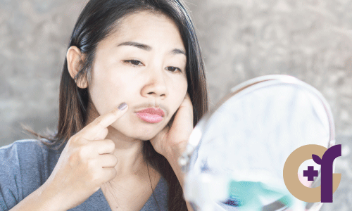 女生唇毛(小鬍子)示意圖
